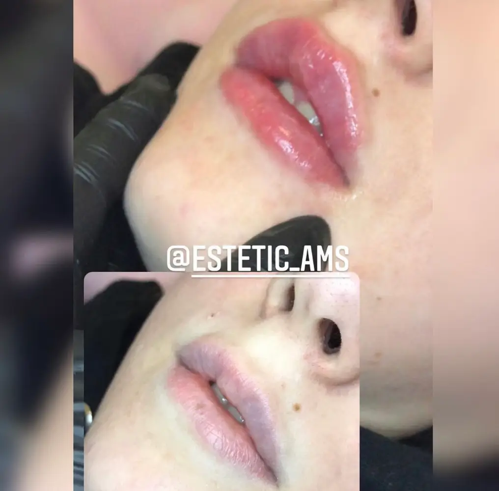 estetic_ams photo 15