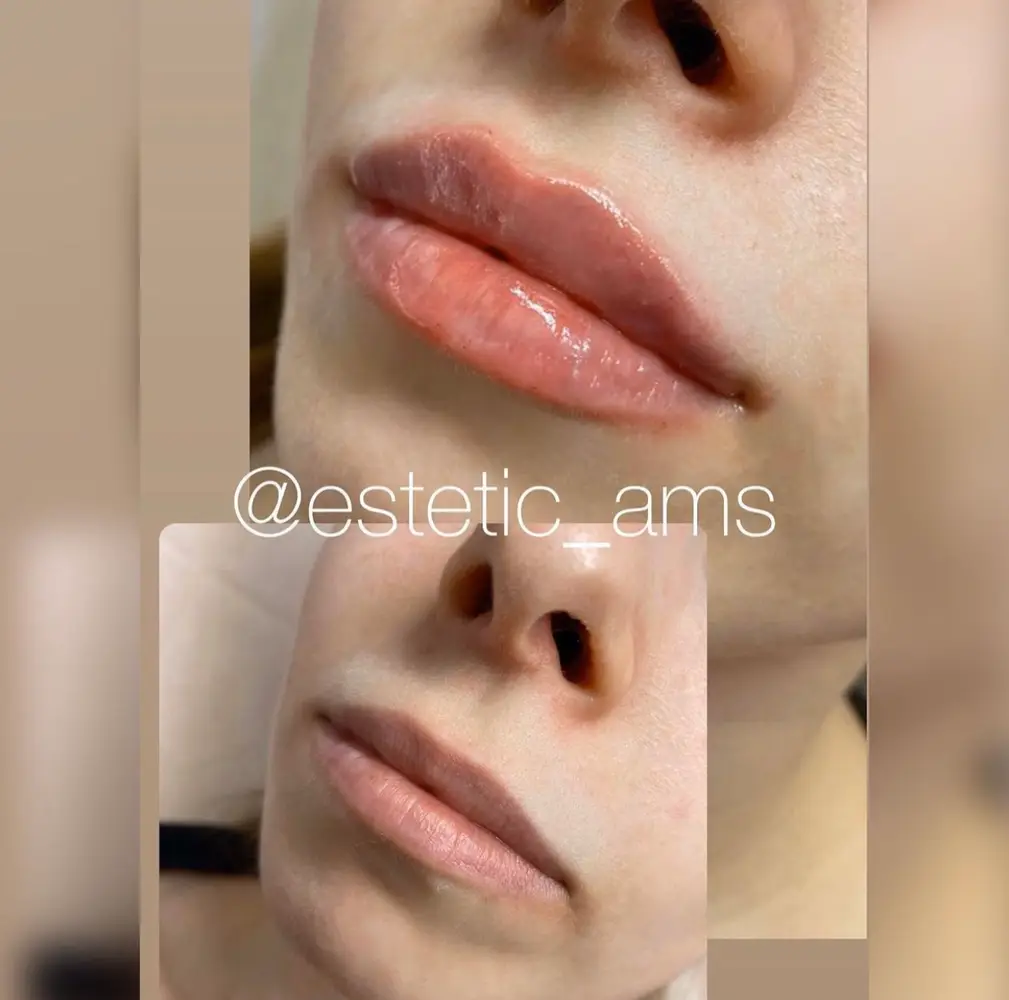 estetic_ams photo 16