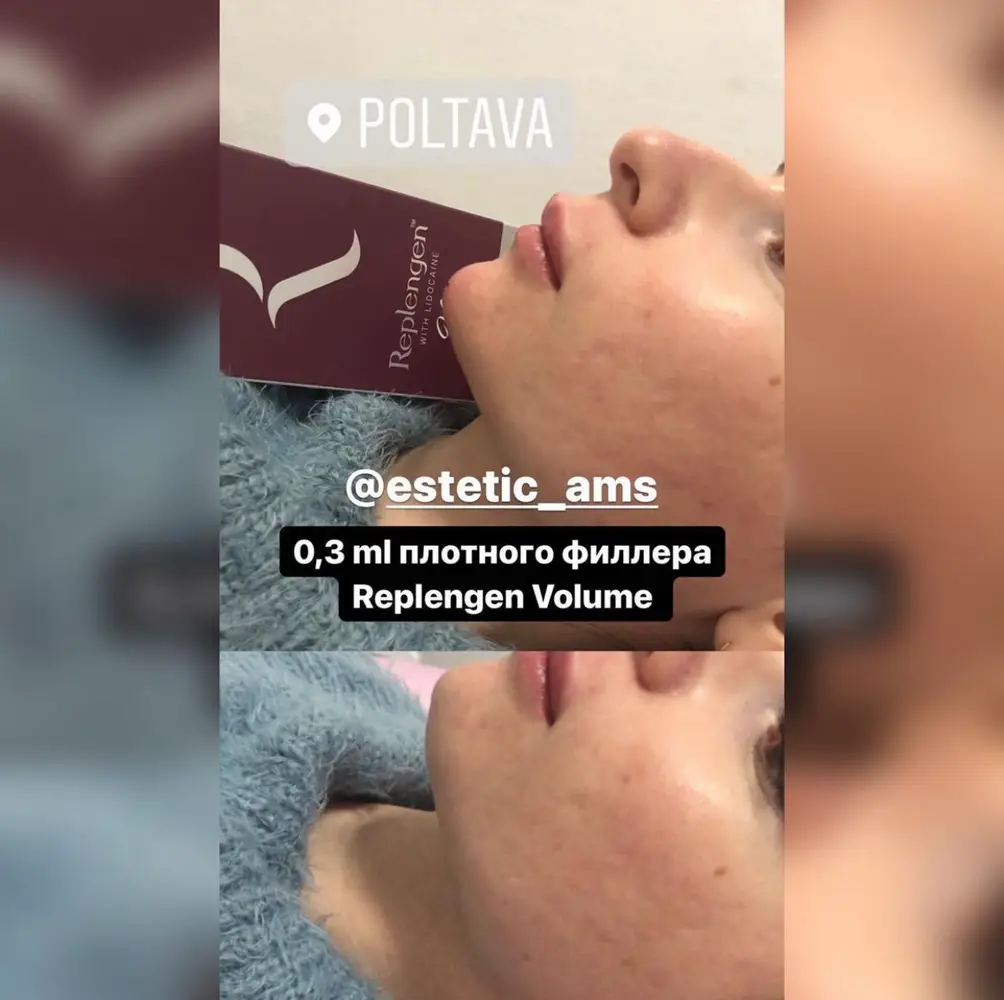 estetic_ams photo 17