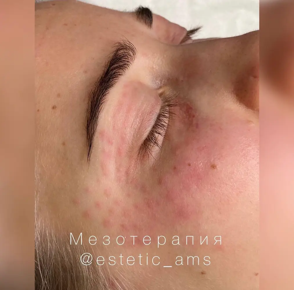 estetic_ams photo 24