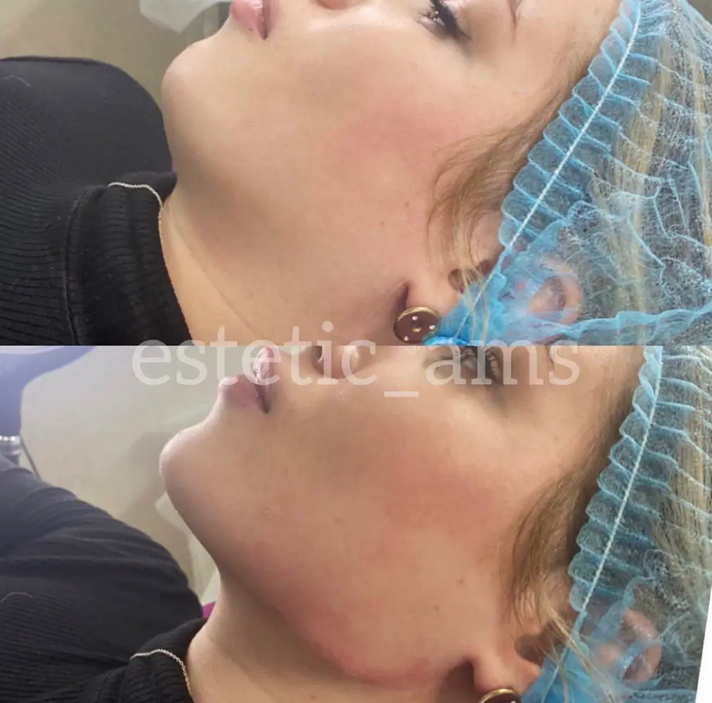 estetic_ams photo 31