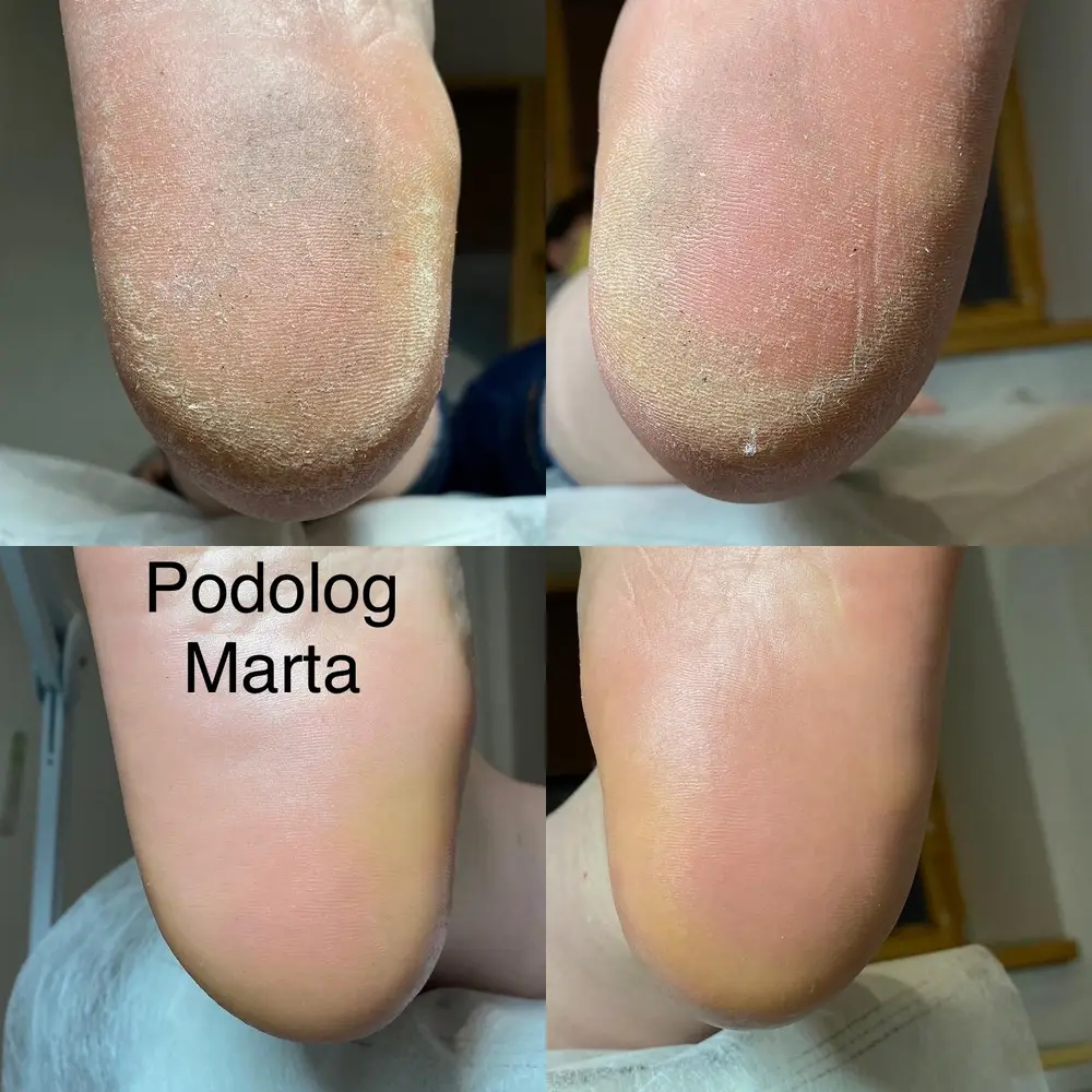 Podo-One photo 8