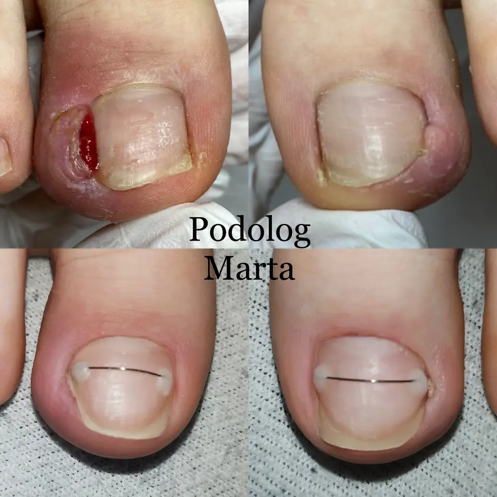 Podo-One photo 9