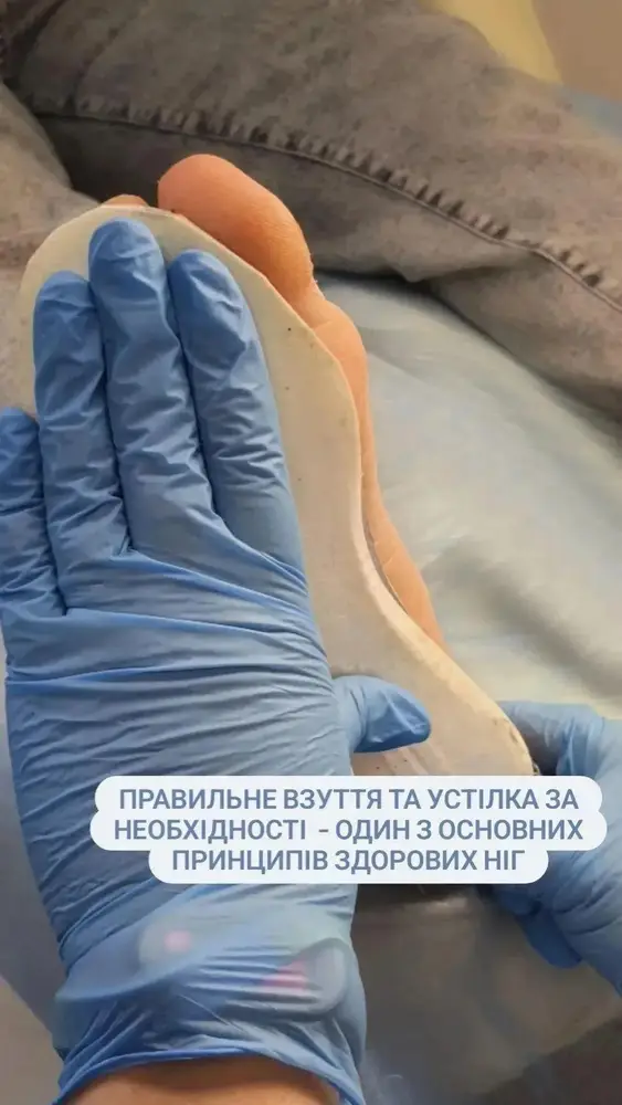 Центр Подології "Harlen" · PodoCenter_HARLEN_Київ, Поділ photo 9