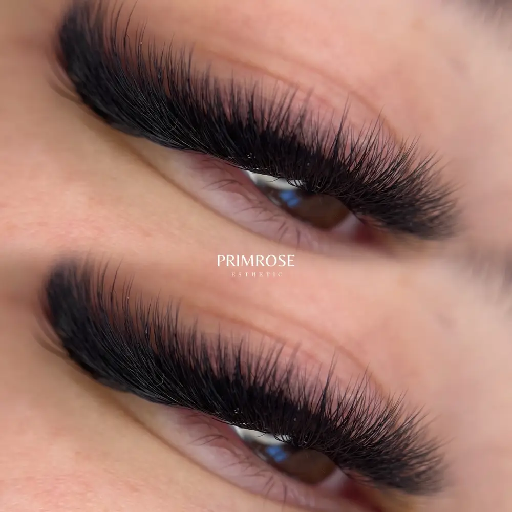 Primrose Esthetic photo 12