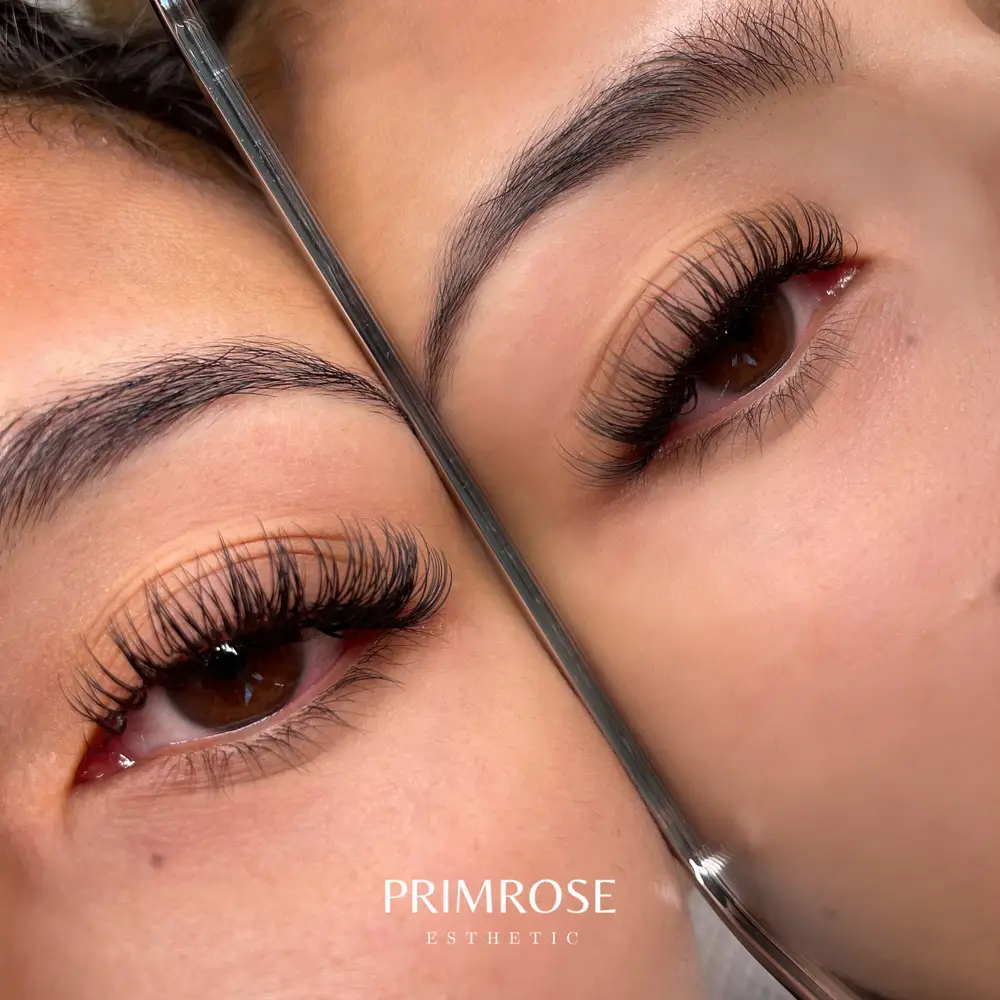 Primrose Esthetic photo 20