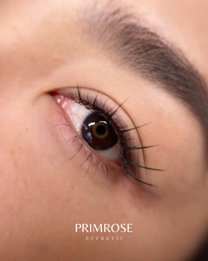 Primrose Esthetic photo 18