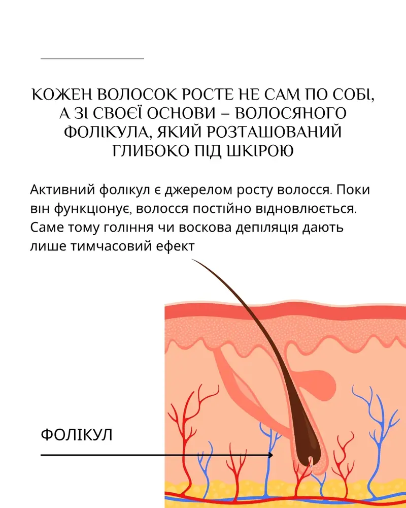 Студія електроепіляції EPIL.KO photo 5