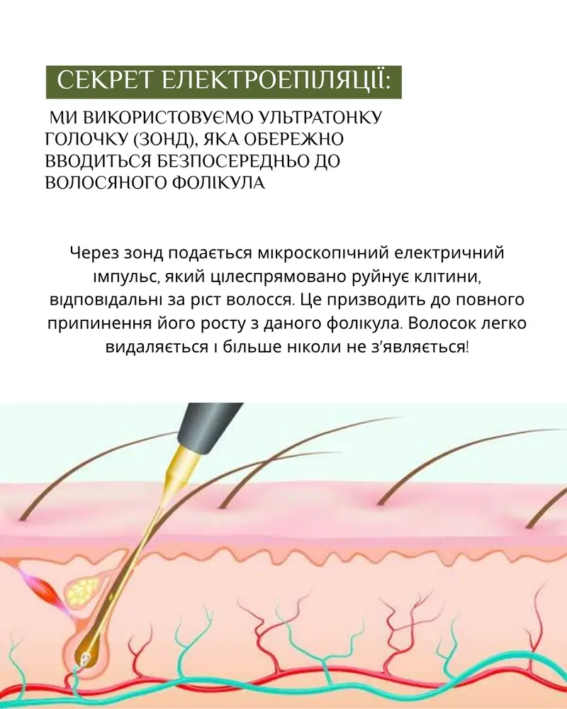 Студія електроепіляції EPIL.KO photo 8