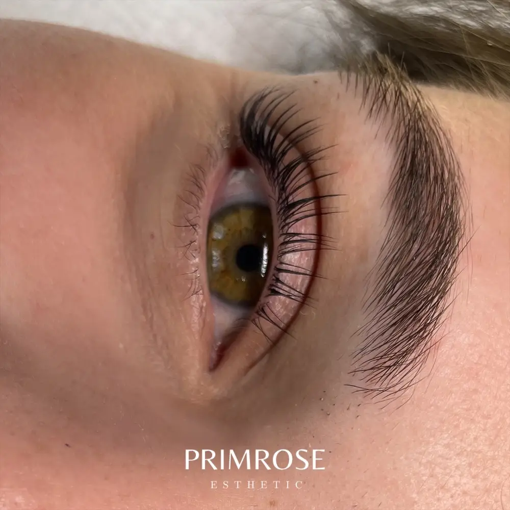 Primrose Esthetic photo 25