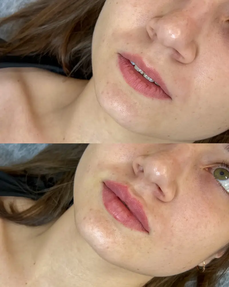 Dr. Anastasiia Matiashok photo 10