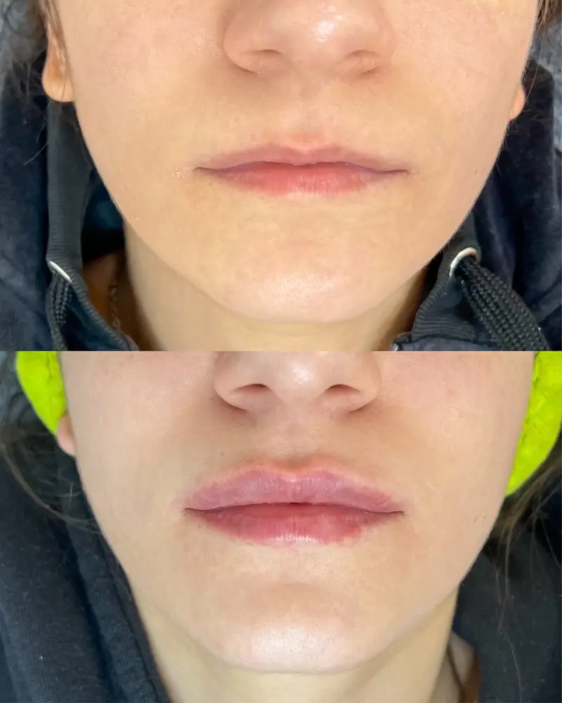 Dr. Anastasiia Matiashok photo 8