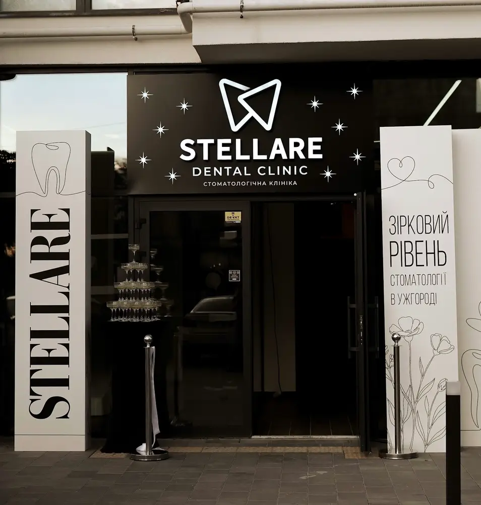 Stellare photo 1