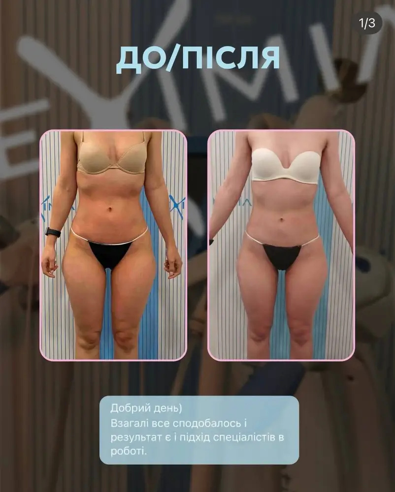 Fit Empire Body Studio | Корекція фігури photo 2