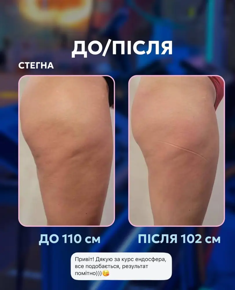 Fit Empire Body Studio | Корекція фігури photo 4